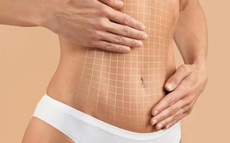 عملية شد البطن لإصلاح العضلات: كيف تعمل