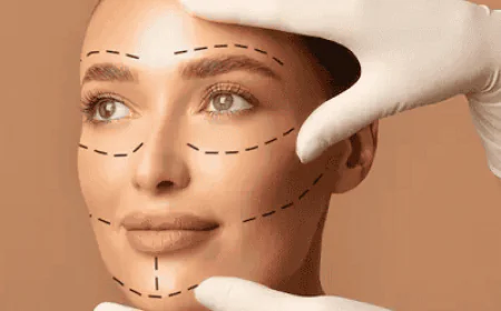 Common Questions About Facelift Surgery Answered