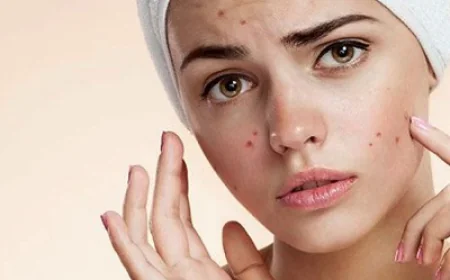 How to Treat Small Acne Bumps With Simple Products