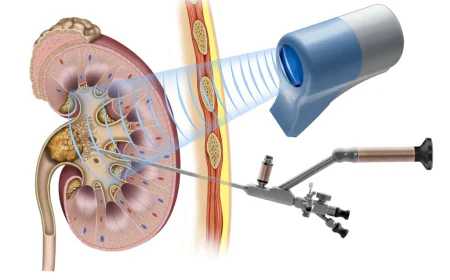 How to Choose the Best Urologist in Jaipur for Advanced Urological Treatment