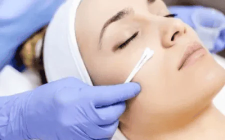 TCA Peel Downtime: Can You Work During Recovery?