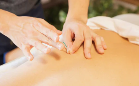 How Personalized Acupuncture Plans Improve Long Term Health