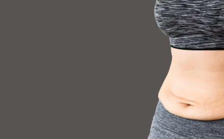 Tummy Tuck as Part of a Mommy Makeover: What Mothers Should Know