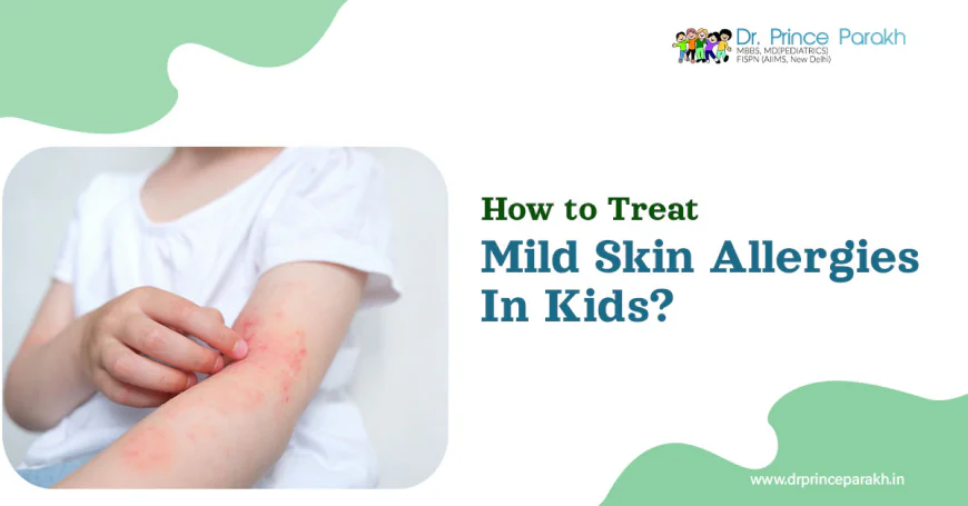How to Treat Mild Skin Allergies in Kids?