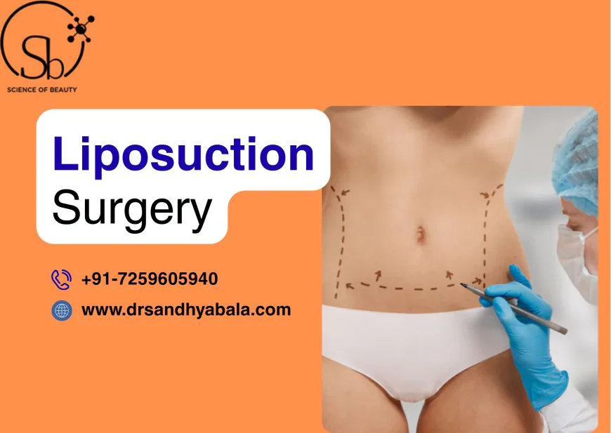 Liposuction in Mommy Makeover: What You Should Know About Targeting Stubborn Fat Areas