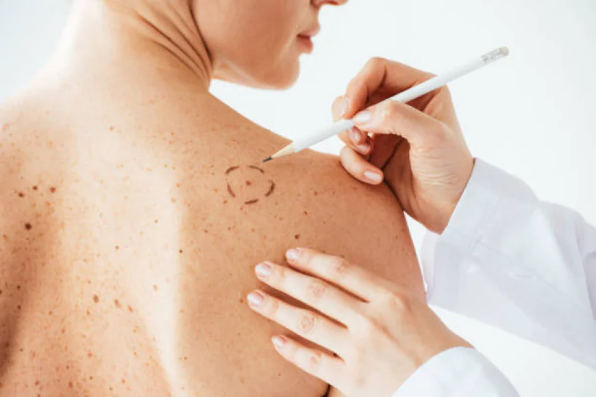 Best Dermatologist in Dubai for Vitiligo Treatment