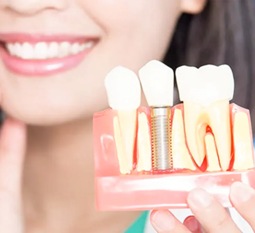 How do single tooth implants help preserve bone and improve oral function?