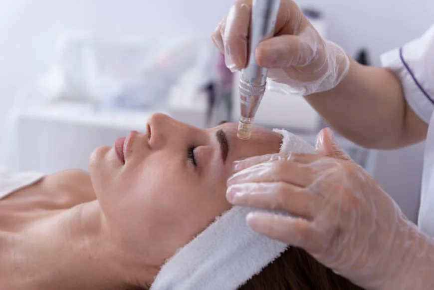 The Ultimate Guide to Microneedling Treatment in Islamabad: Achieve Flawless Skin