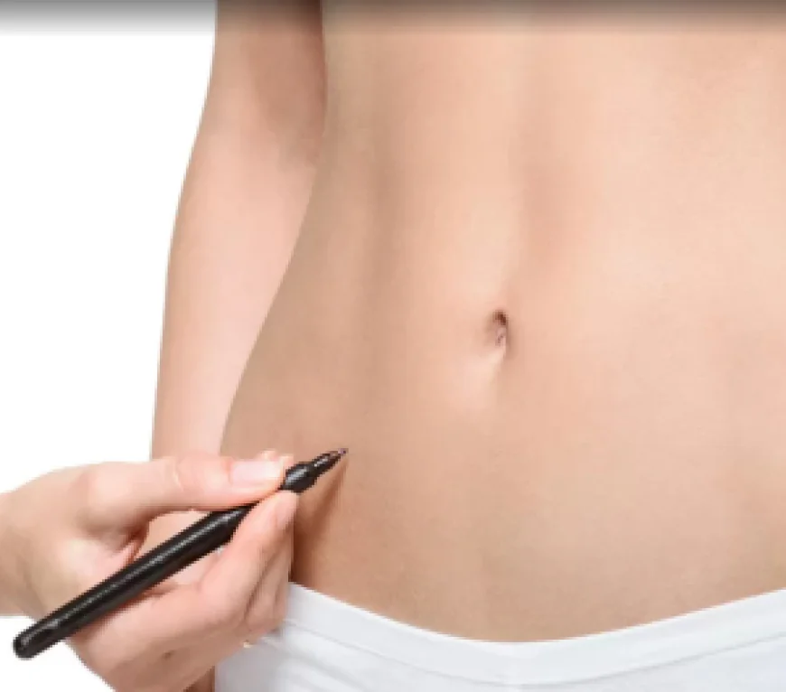 Liposuction in Dubai: Refine Your Shape with Medical Precision
