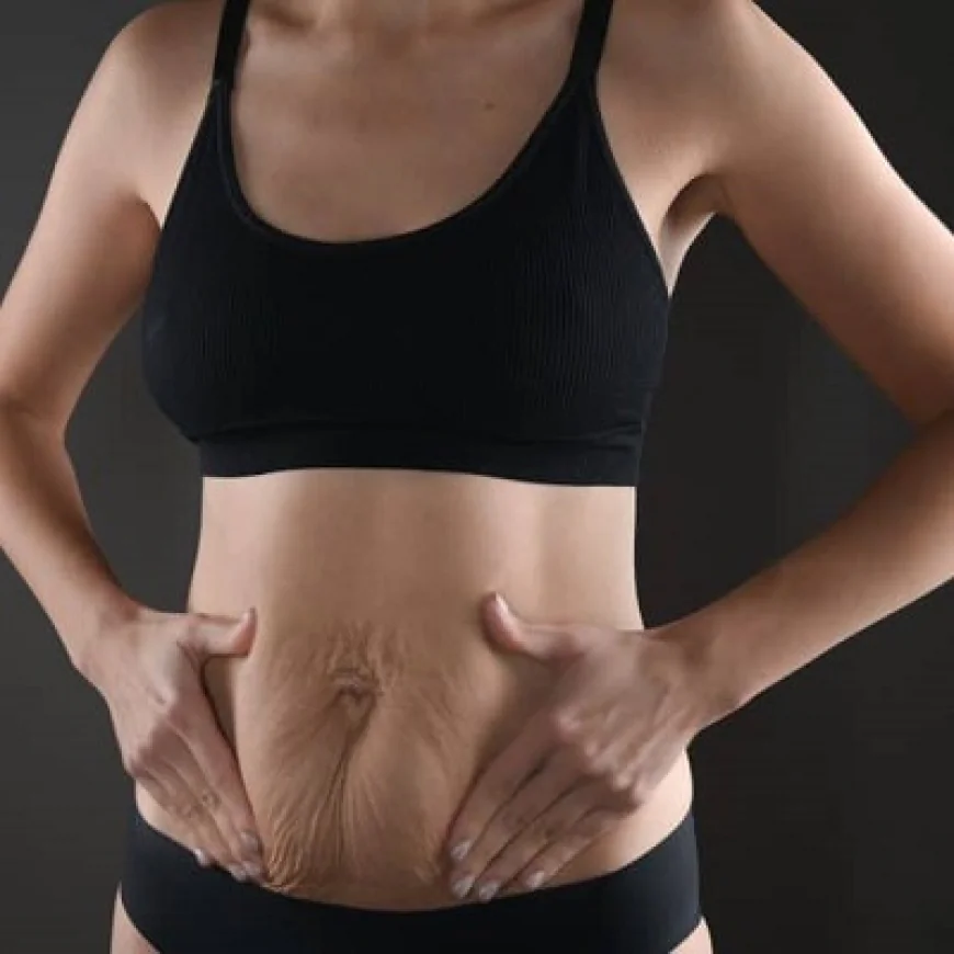 Tight Clothes After Tummy Tuck: Risks & Tips