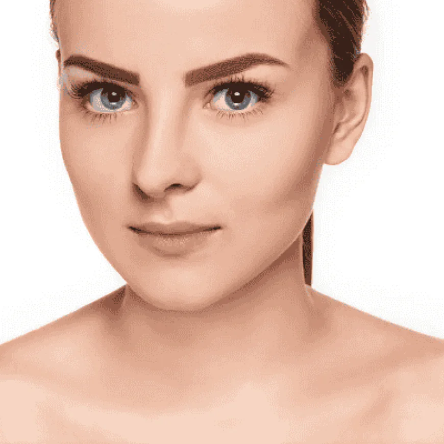 Aesthefill Injection Longevity Compared to Other Fillers