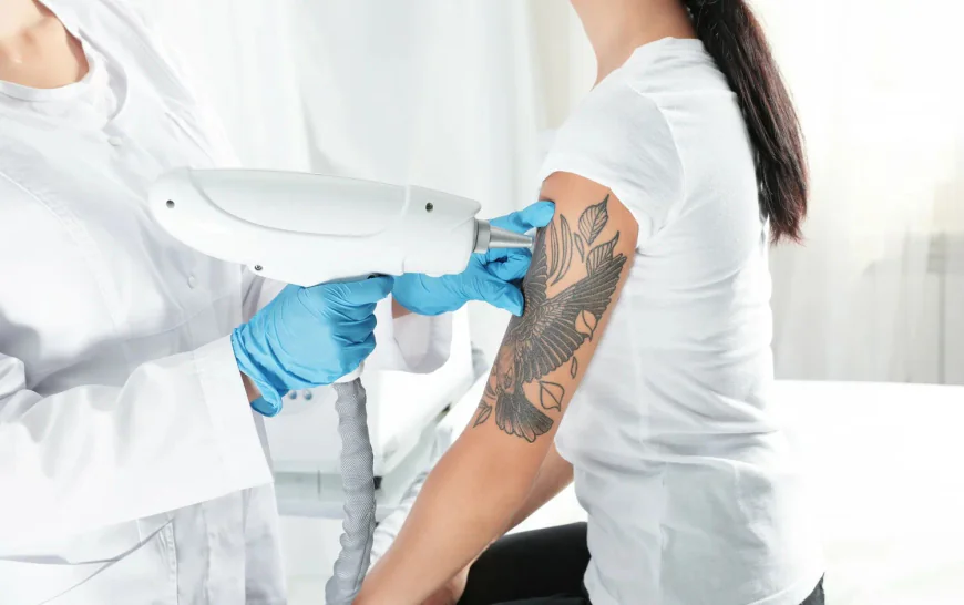 Tattoo Removal in Dubai Reviews: Real Patient Stories
