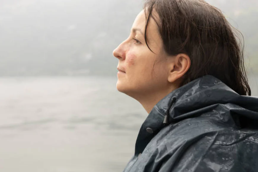 Birthmark Removal in Dubai | High-Quality Results