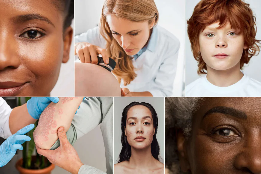 Chemical Peel Treatment in Indirapuram – Expert Skin Rejuvenation Solutions