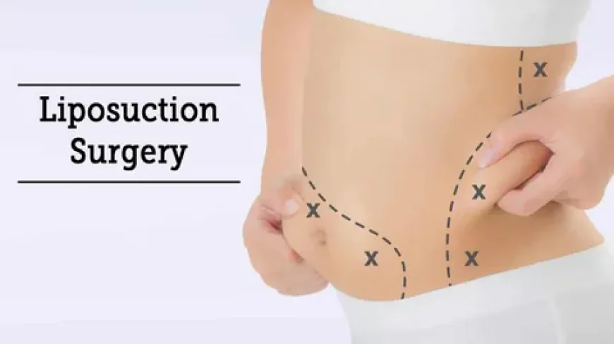 Liposuction in Dubai for Abs: Achieving High-Definition Results