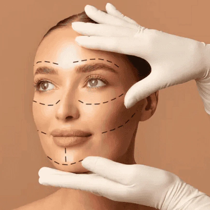 Common Questions About Facelift Surgery Answered