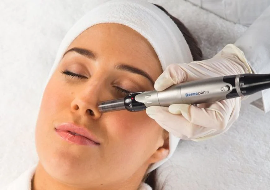 Dermapen Therapy in Dubai for Glowing Skin