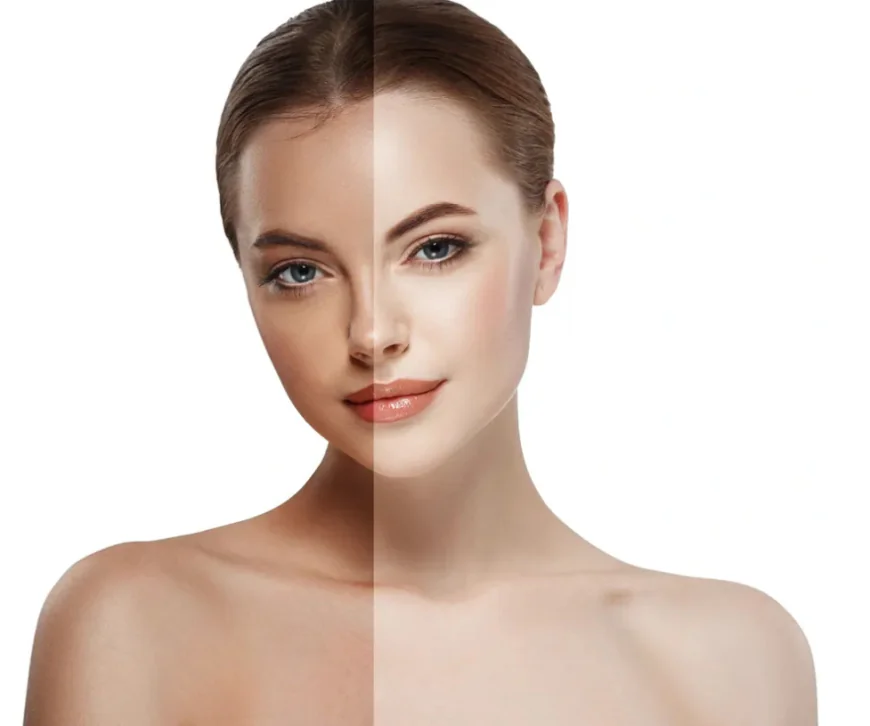 Deep Cleansing Facial in Dubai