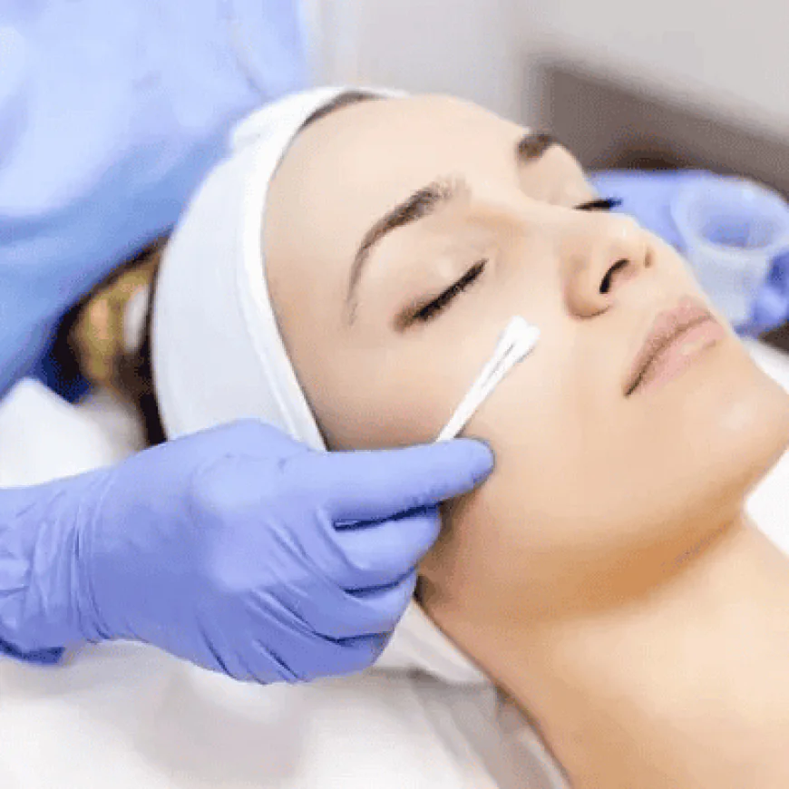 TCA Peel Downtime: Can You Work During Recovery?