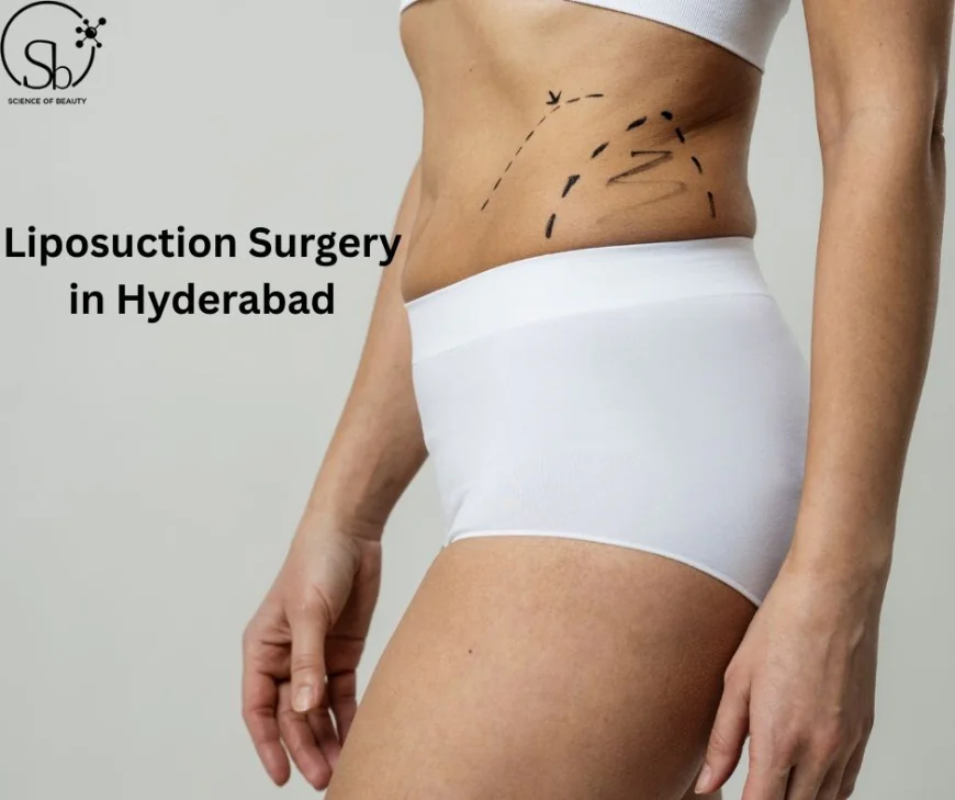 How Much Fat Can Be Safely Removed in Liposuction?