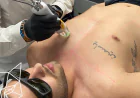 Why More Men Are Choosing Male Hair Removal in Sydney