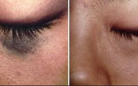 A Friendly Guide to Choosing the Best Birthmark Removal Clinics in Dubai