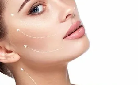 Does Silhouette Soft Lift Improve Overall Facial Contouring?