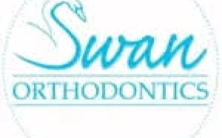 How Invisalign Aligners Work to Transform Your Smile Step by Step