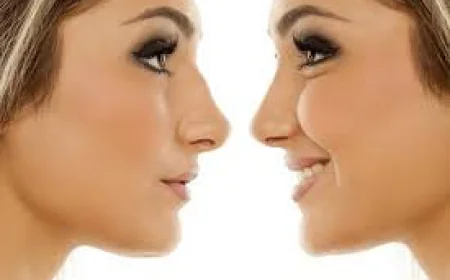 Best Rhinoplasty Surgeons in Dubai: A Comprehensive Guide
