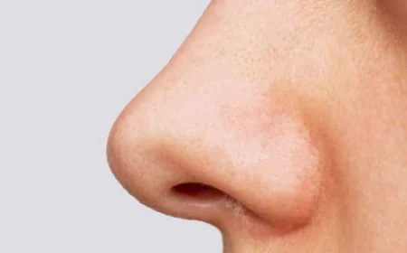 تغيرات الثقة بعد جراحة تجميل الأنف