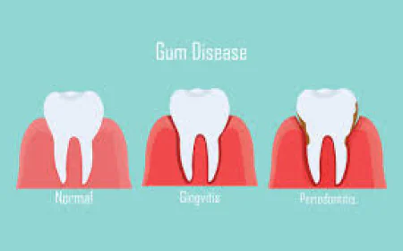 Common Bleeding Gums Causes You Should Never Ignore Today