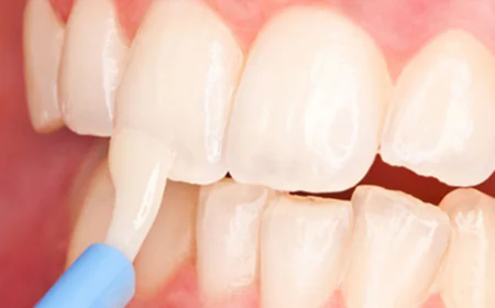 How Does Fluoride Treatment Work?