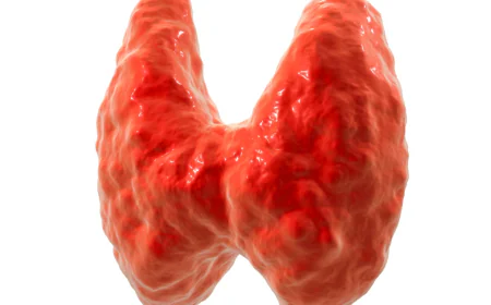 What You Need to Know About Thyroid Ablation Procedures