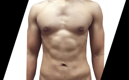 How Long Is the Recovery After a Tummy Tuck in Houston?