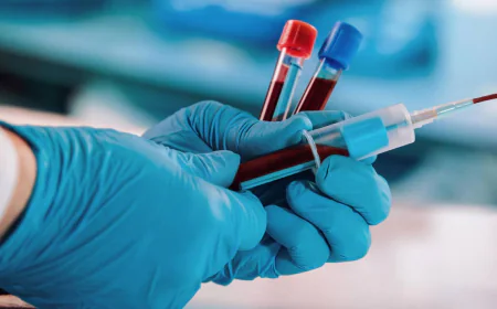 Hepatitis B Test for Blood Donors: Safety First