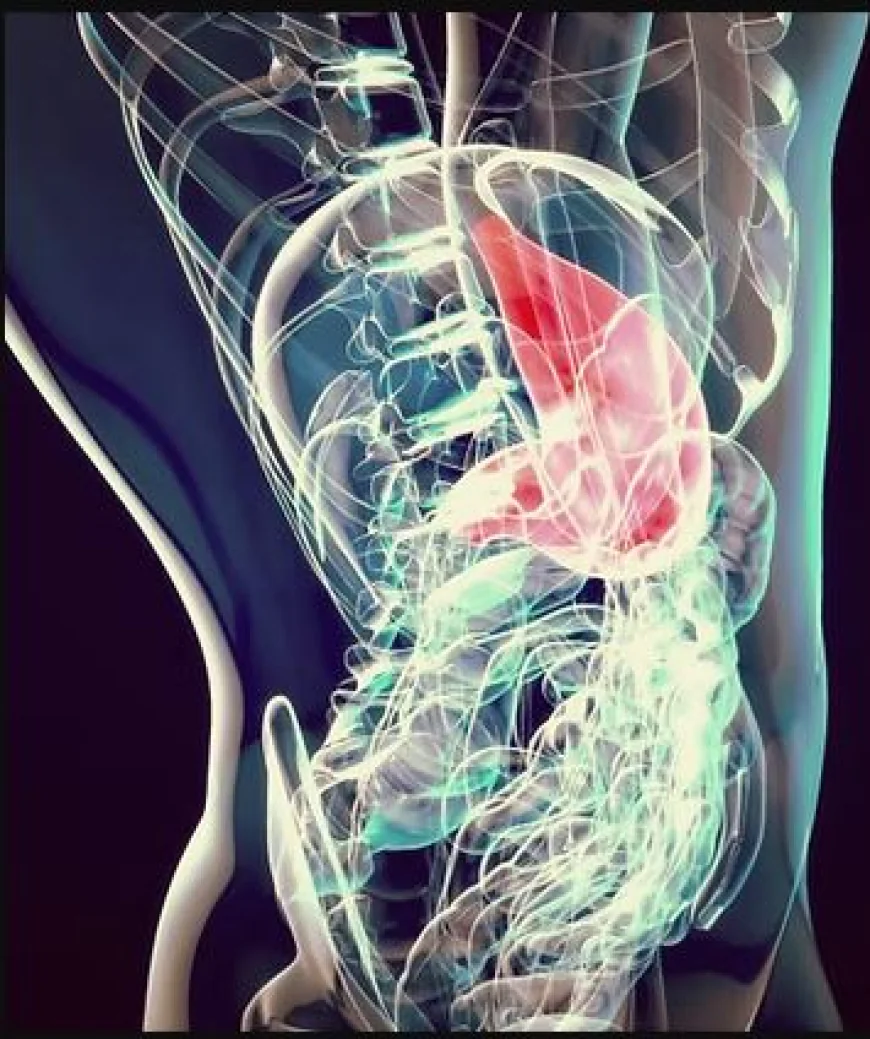 Gallbladder Removal Singapore: Safe Procedures, Recovery, and What to Expect