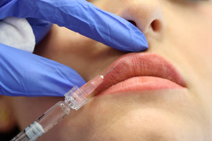 Russian Lip Fillers in Dubai for Sexy Smile