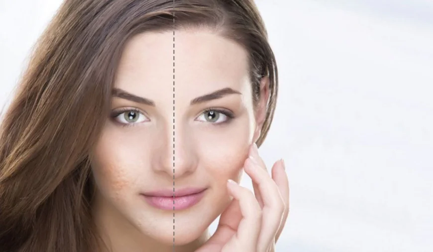 Top Dermatologists for Skin Whitening Treatment in Dubai