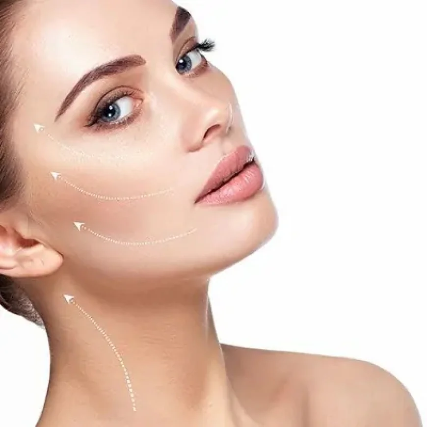 Does Silhouette Soft Lift Improve Overall Facial Contouring?
