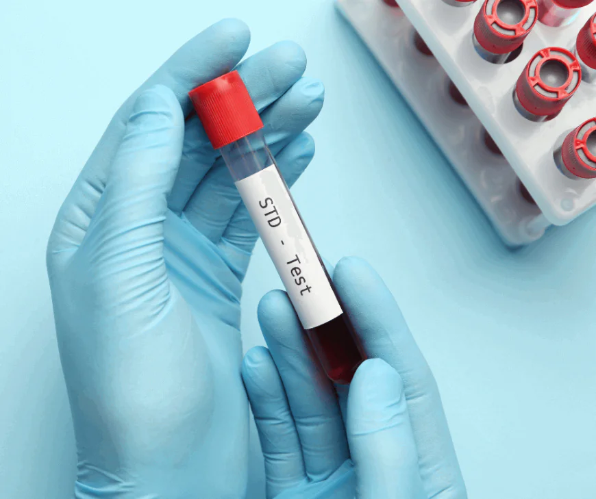 STD Test in Dubai: What You Need to Know Before Booking