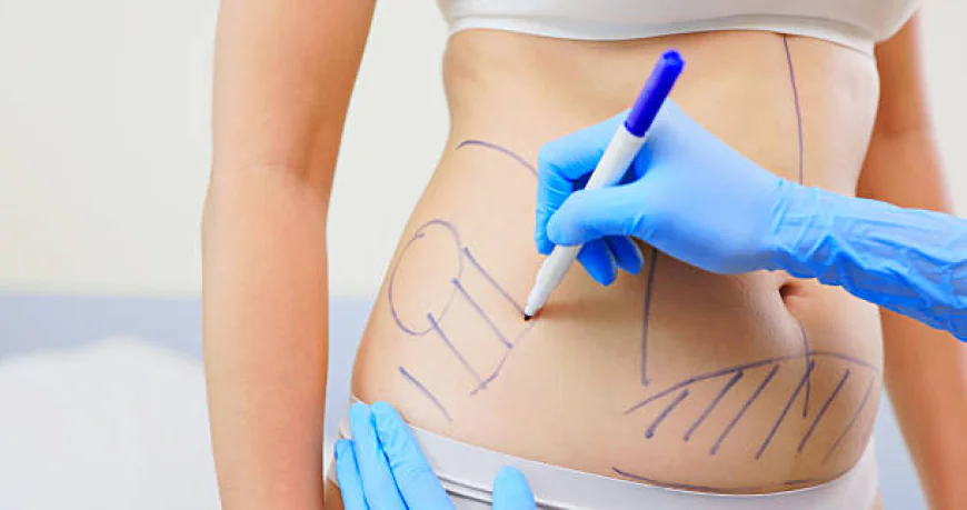 Liposuction in Dubai: Cost-Effective Body Contouring Options