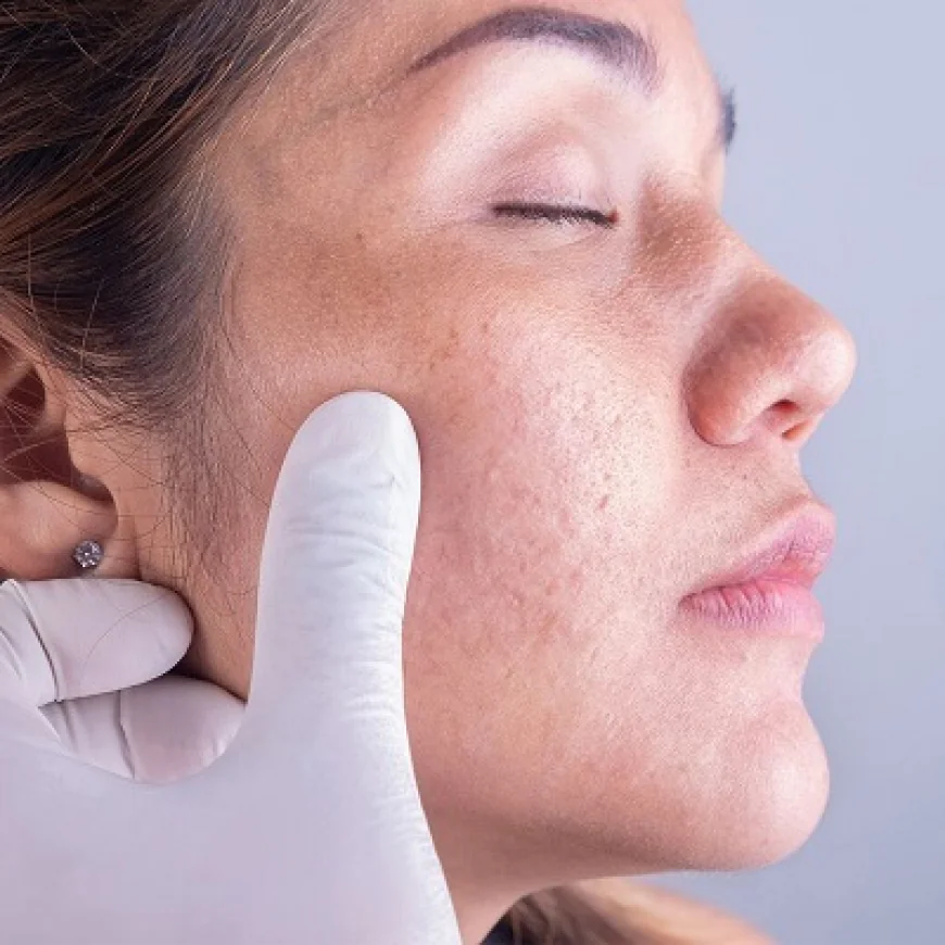 علاجات الاحمرار من أطباء الجلدية