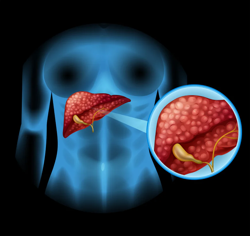 When Does Pancreatic Disease Require Surgery? Warning Signs to Know