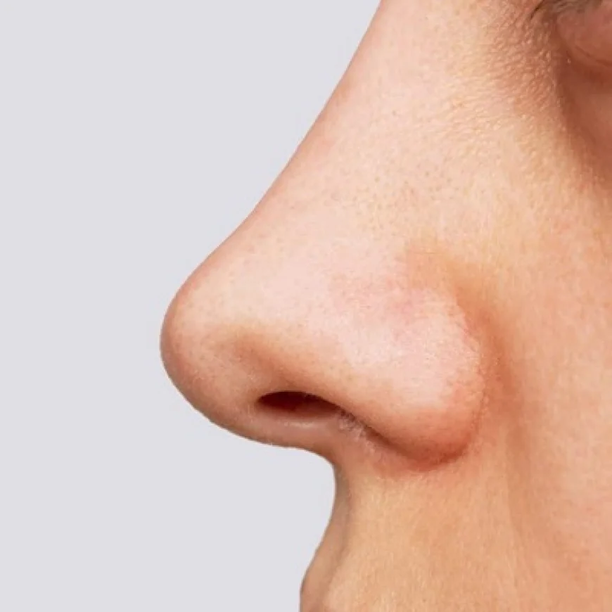 توصيات غذائية بعد جراحة تجميل الأنف