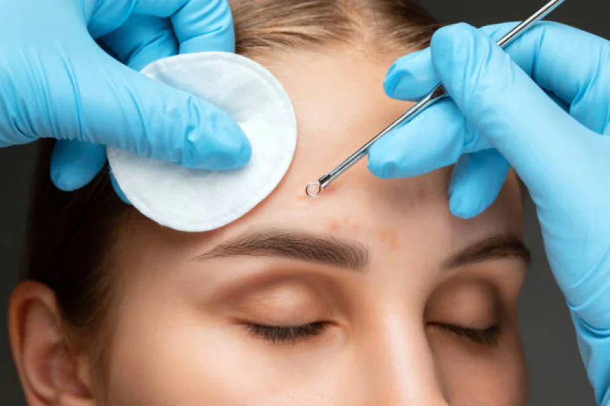 Pimple Treatment in Dubai: HydraFacial for Deep Pore Cleansing