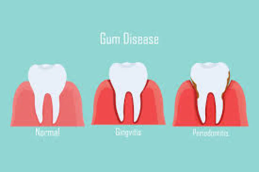 Common Bleeding Gums Causes You Should Never Ignore Today