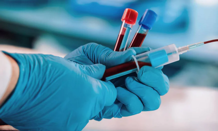Hepatitis B Test for Blood Donors: Safety First