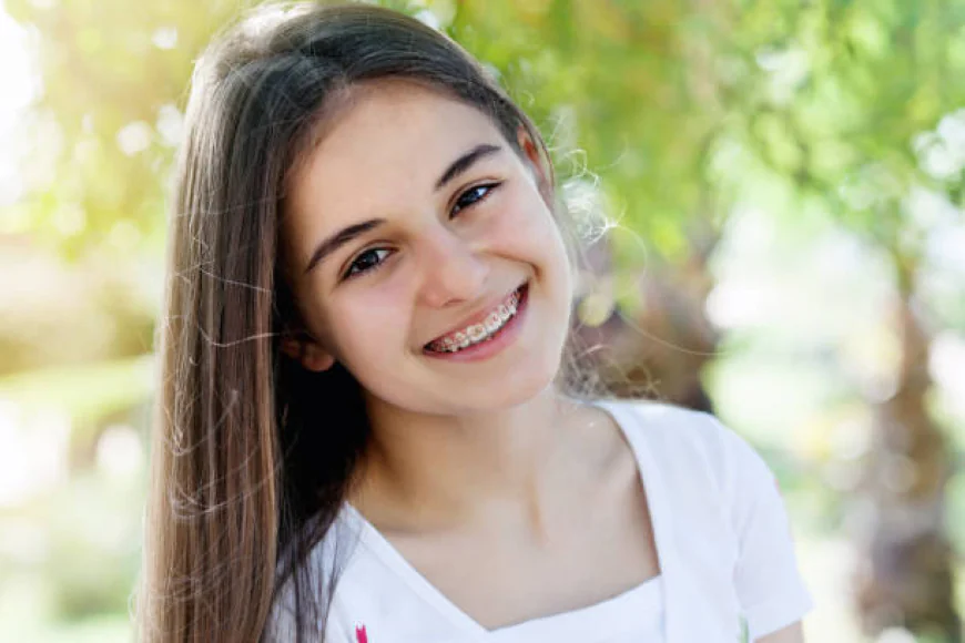 Teeth Braces Treatment in Islamabad: A Complete Guide to a Confident Smile