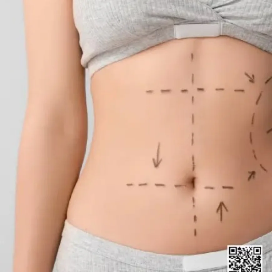 Liposuction in Islamabad – Achieve Your Ideal Body Shape