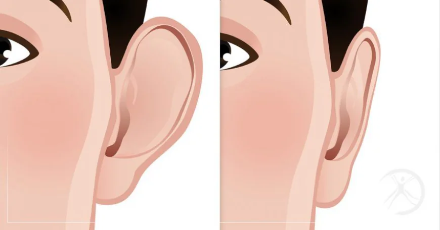 Achieve Perfectly Shaped Ears with Ear Reshaping in Islamabad